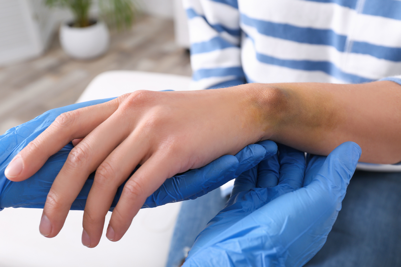 A close-up of the gloved hand of a doctor checking a bruise on a young woman's wrist.